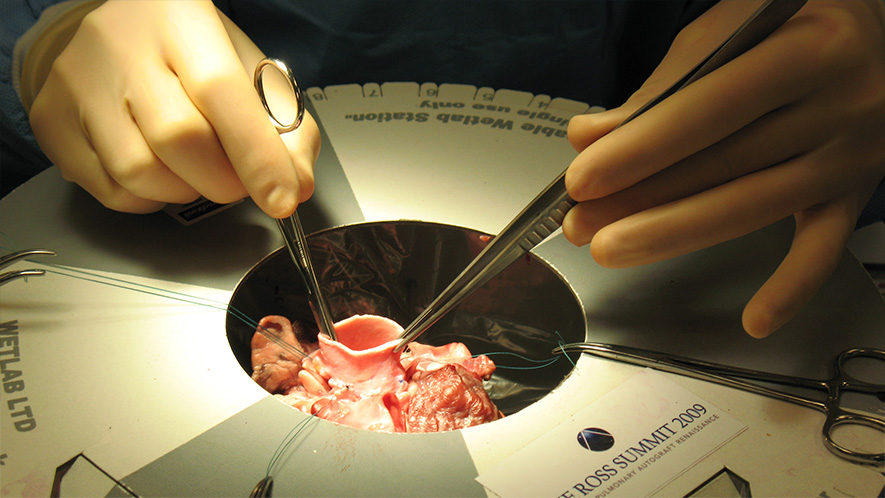 hero-Aortic-Allograft-Workshops Aortic Allograft Workshops