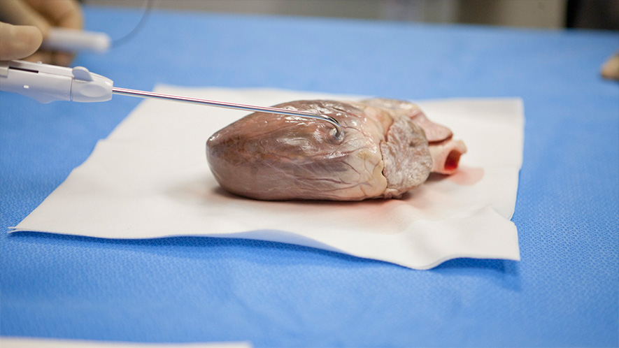 TMR-Workshops-image Transmyocardial Revascularization (TMR) Training Workshops