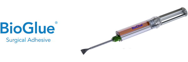 inc mechanical s Surgical Inc. BioGlue CryoLife, Adhesive inc mechanical s Surgical Inc. BioGlue CryoLife, Adhesive