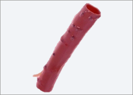 CryoGraft-Descending-Thoracic-Aorta CryoGraft Descending Thoracic Aorta