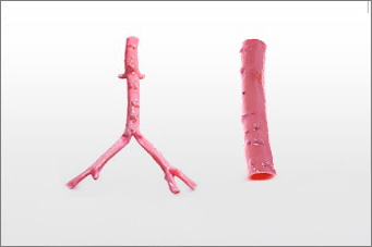 image-CryoLife-Aortoiliac-Artery CryoLife Aortoiliac Artery