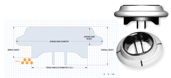 mitral-heart-valve-with-conformx-sewing-ring Mitral Heart Valve with Conform-X Sewing Ring
