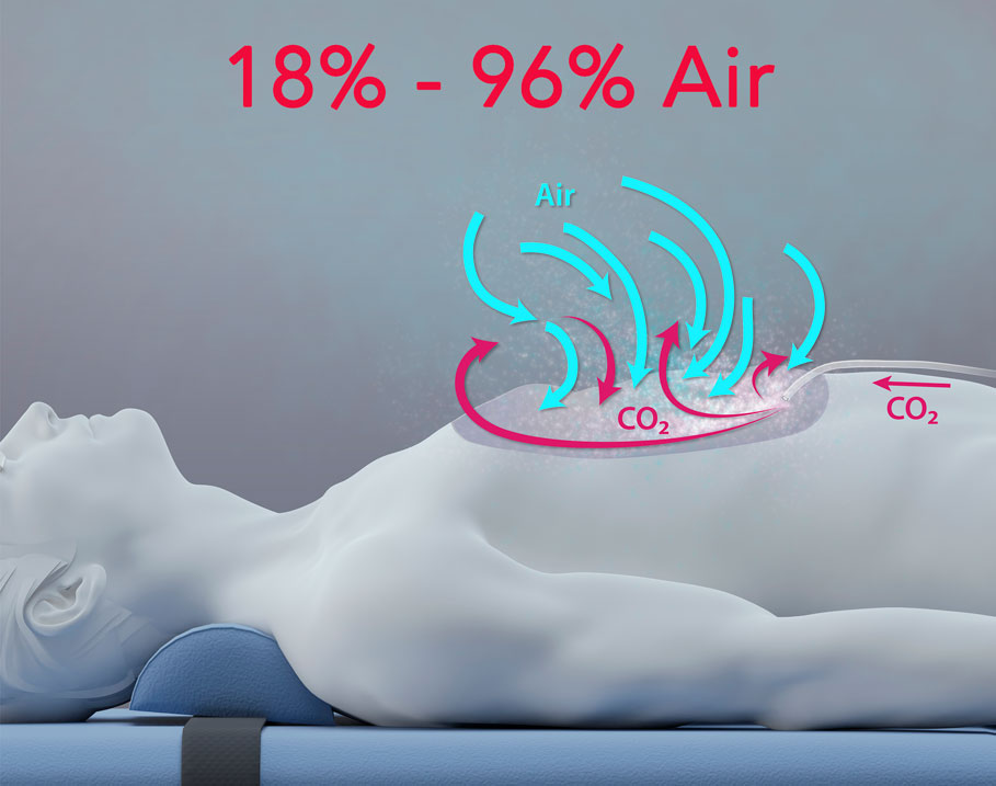 18-96-Air-CarbonAid 18% - 96% Air - CarbonAid
