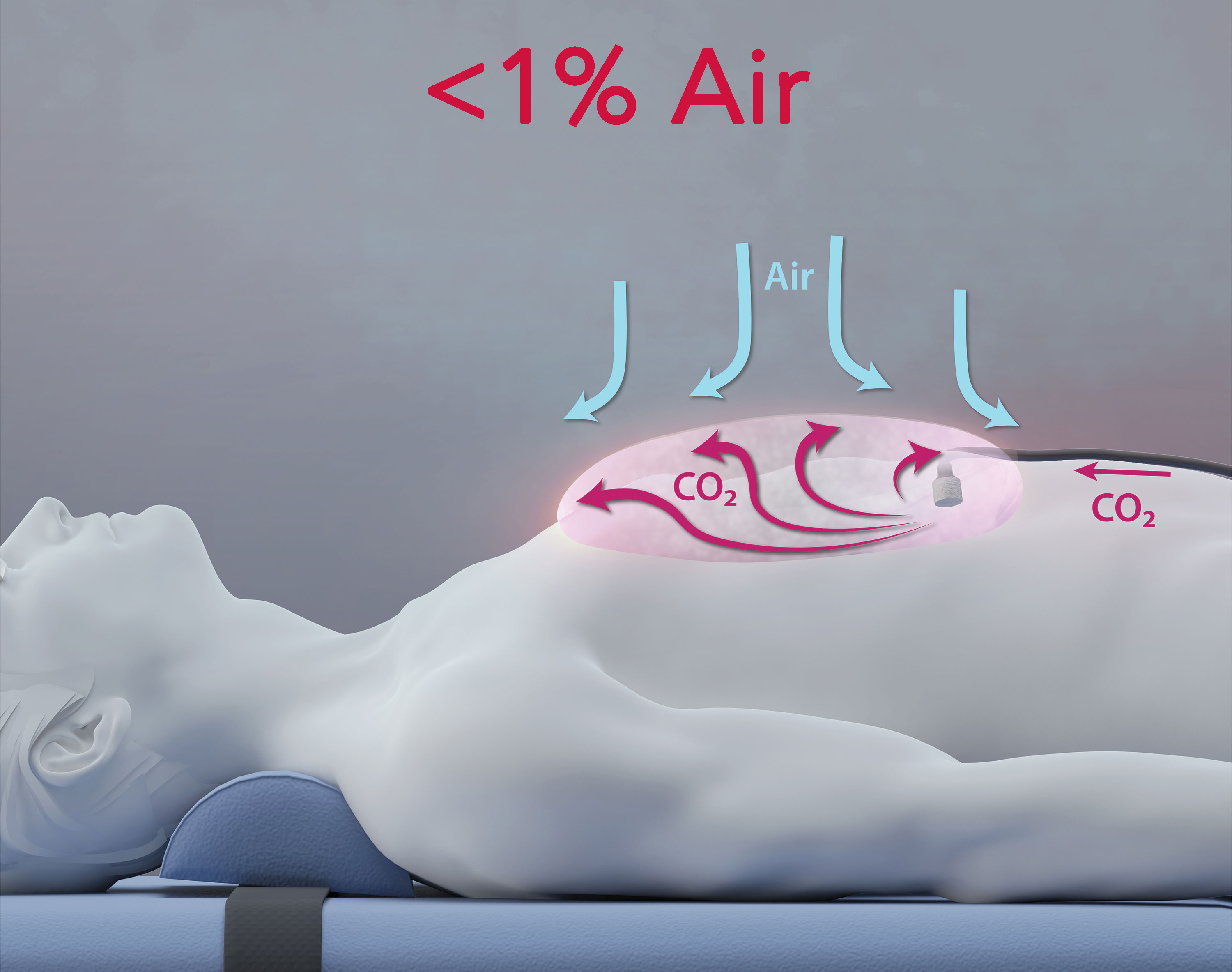 Less-than-1-Air-CarbonAid Less than 1% Air - CarbonAid